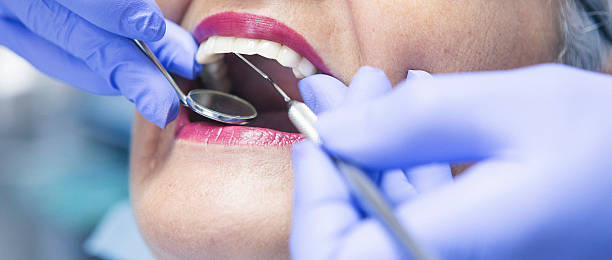 Best Urgent Care for Lost Fillings or Crowns in Bowman, ND